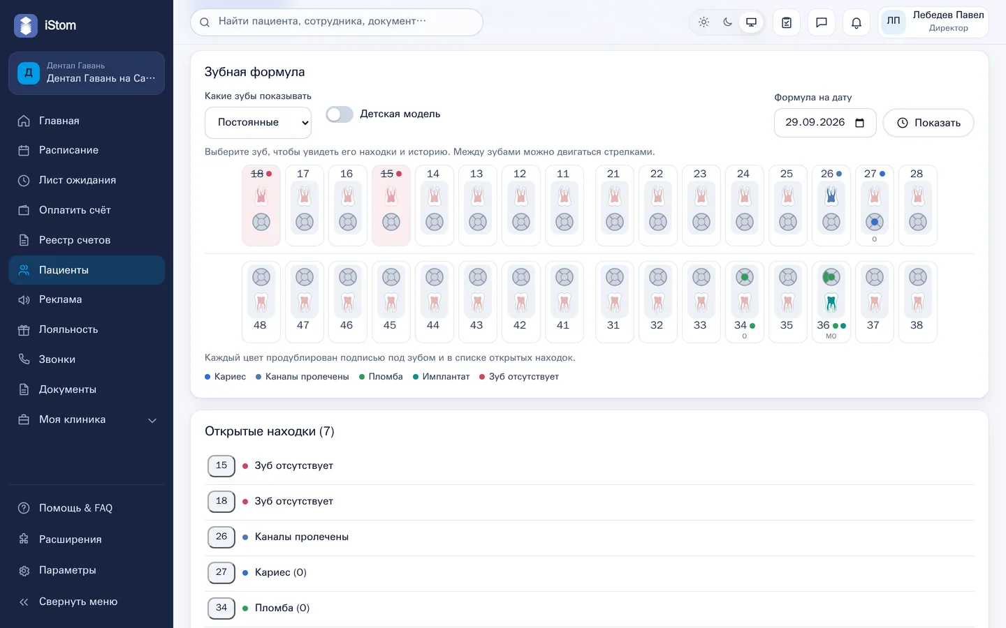 Графическая зубная формула — Карта пациента и зубная формула